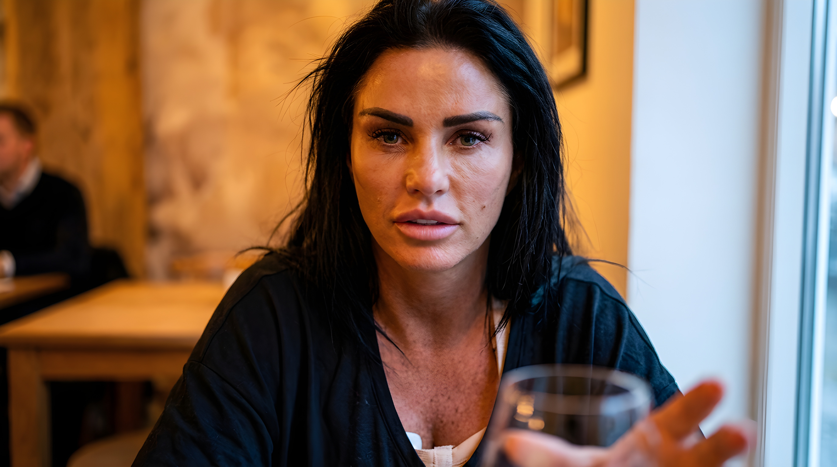 Katie Price viser vildt resultat efter ny operation